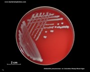 klebsiella on sheep blood agar